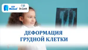 деформация грудной клетки