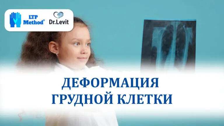деформация грудной клетки