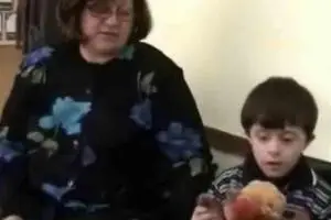 Синдром дауна