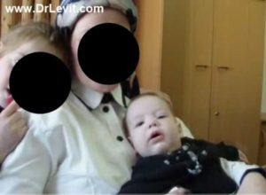 Слепой малыш 7 месяцев после сеансов у доктора Левит стал видеть