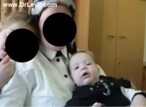 Слепой малыш 7 месяцев после сеансов у доктора Левит стал видеть