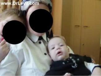 Слепой малыш 7 месяцев после сеансов у доктора Левит стал видеть