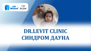 синдром дауна